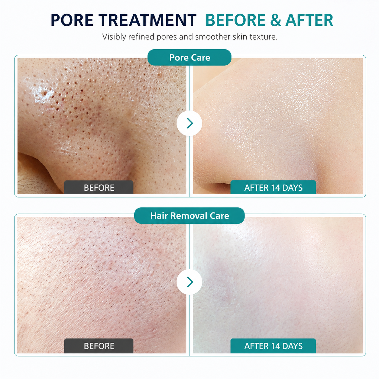 Pore Tightening Serum