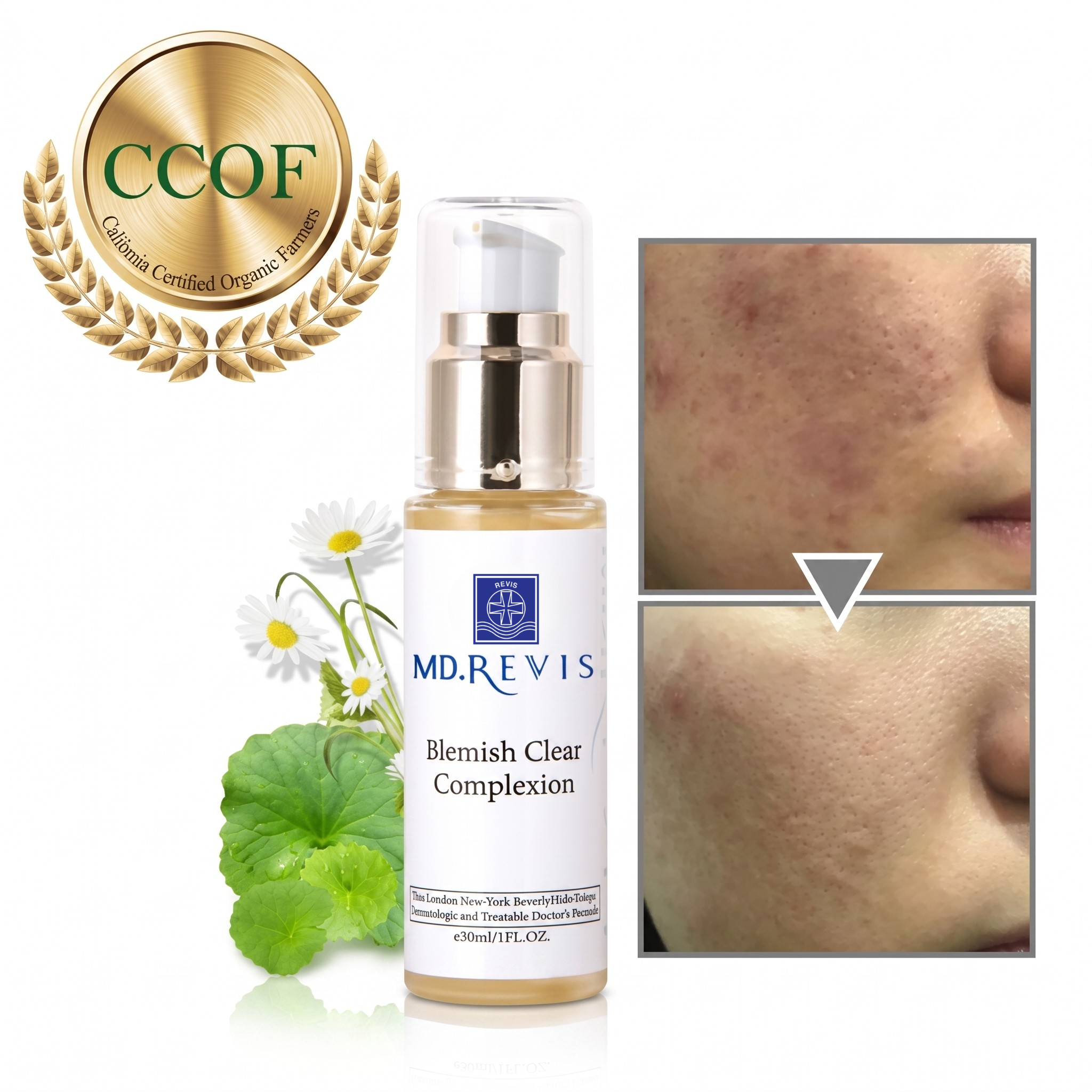 Blemish Clear Complexion