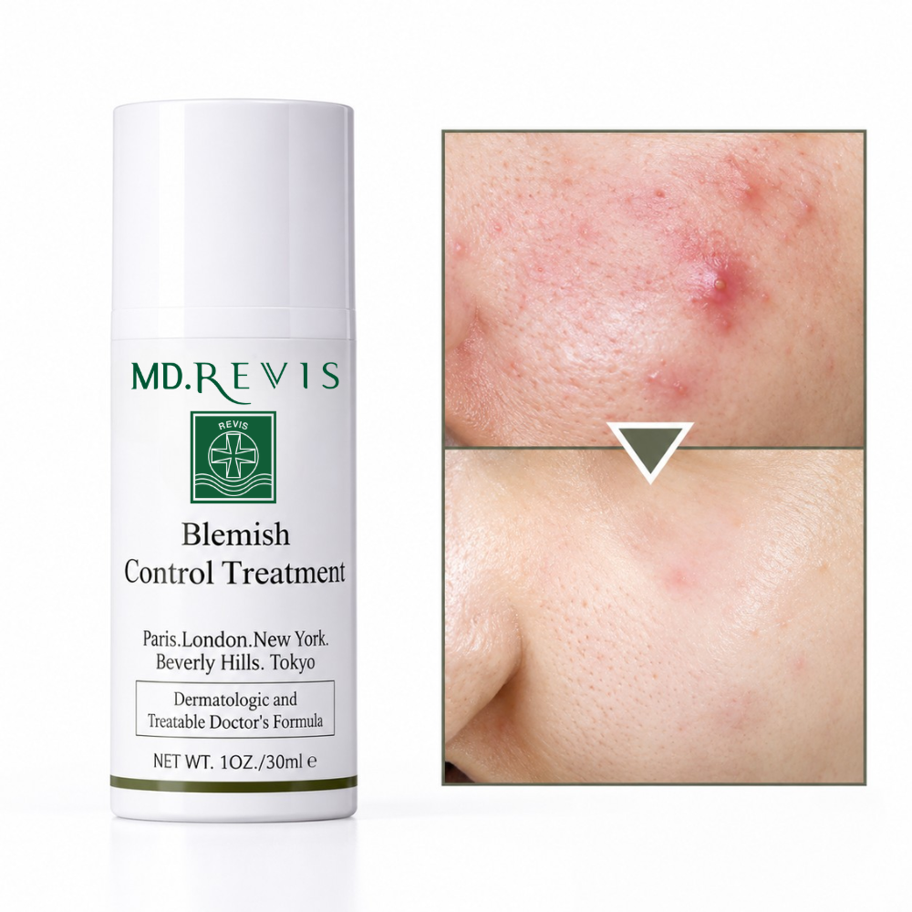 Blemish Control Treatment