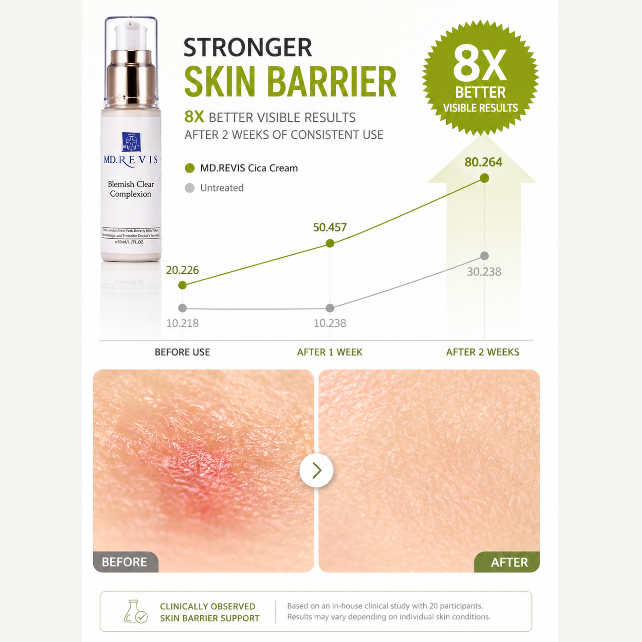 Blemish Clear Complexion